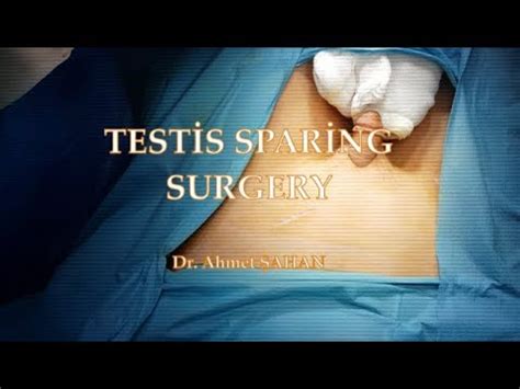 Slide animation describing the surgical procedure for Removal of one or both Testis (Orchiectomy) that is done for prostate cancer, . . Orchiectomy surgery video